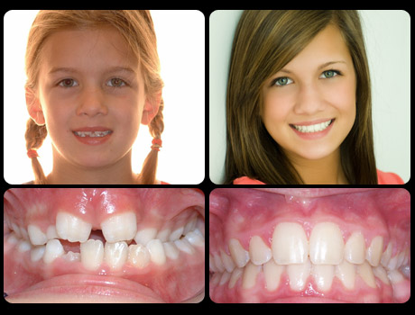 K. Kareus was treated in 15 months TX time
